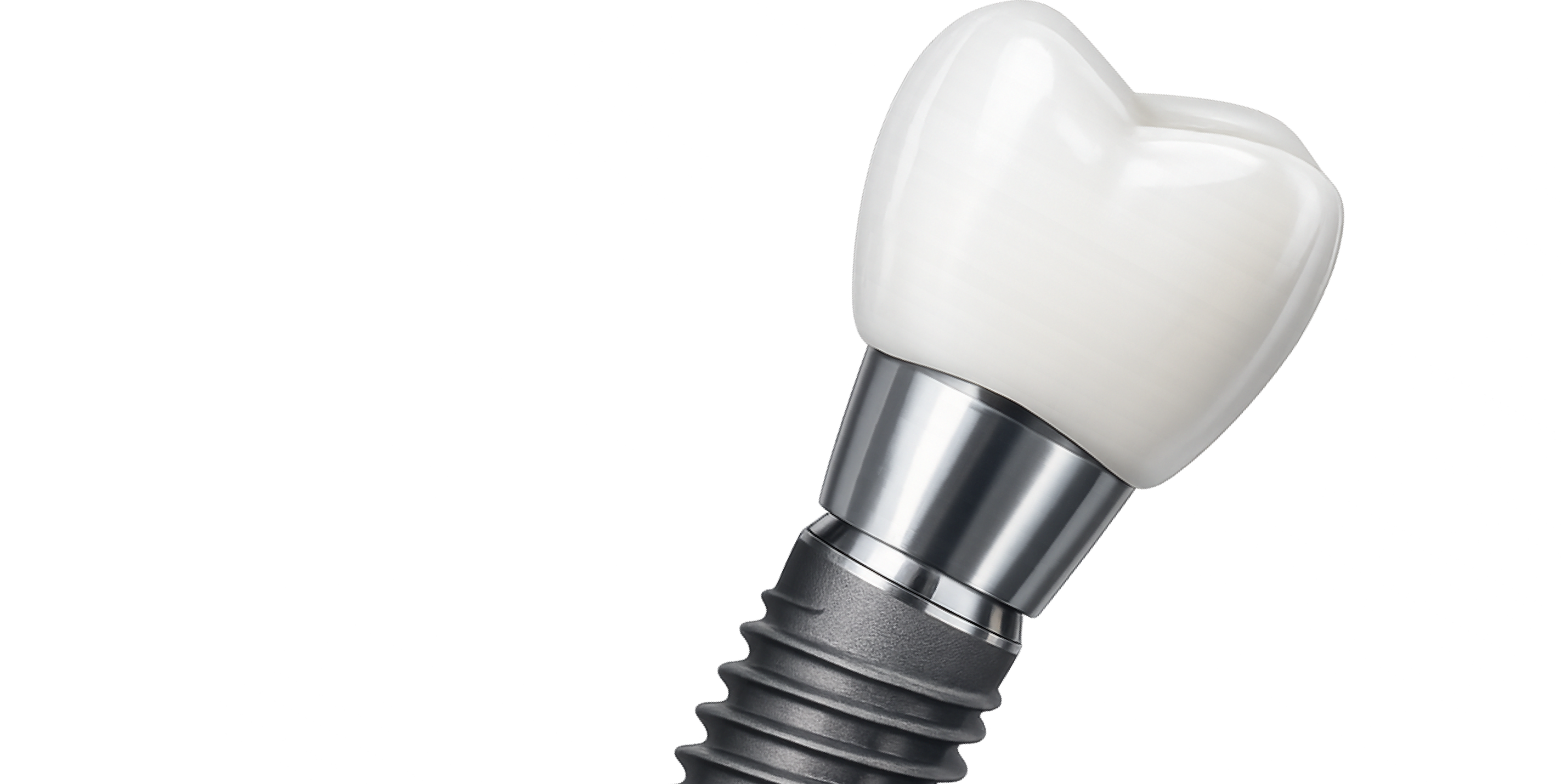 Дентальный имплант